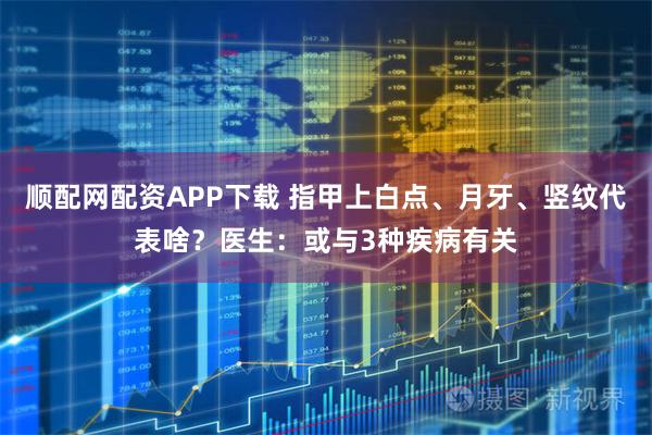 顺配网配资APP下载 指甲上白点、月牙、竖纹代表啥？医生：或与3种疾病有关